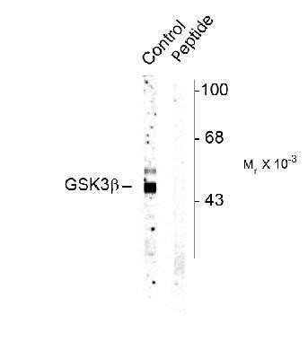 Western Blot: GSK-3 alpha/beta [p Ser9] Antibody [NB300-741]